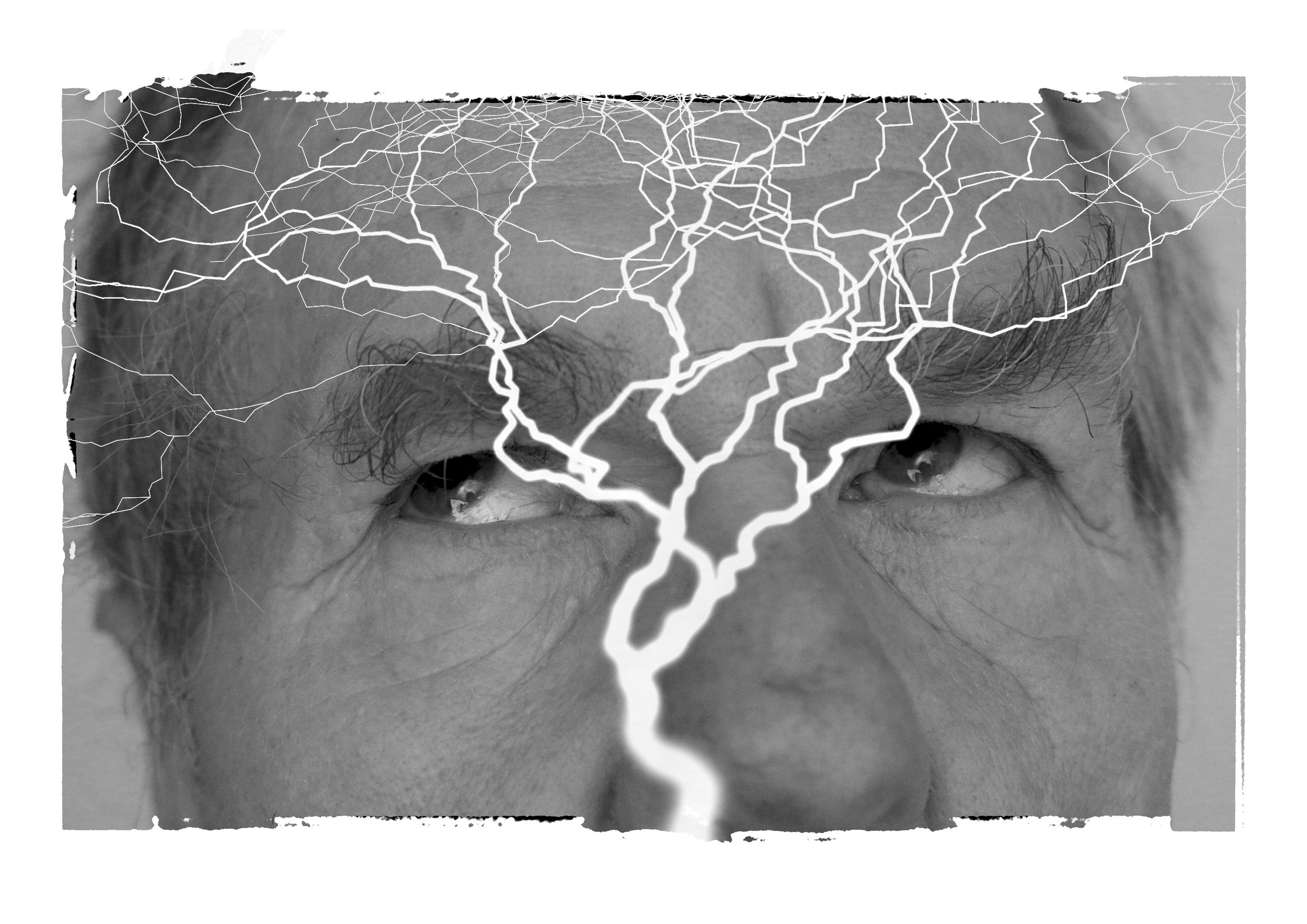 Epilepsia: ce trebuie să faci dacă o persoană are o criză și ce greșeli trebuie evitate